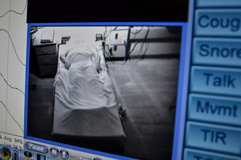 Depression’s hidden toll: Sleep, not weight, may drive diabetes risk