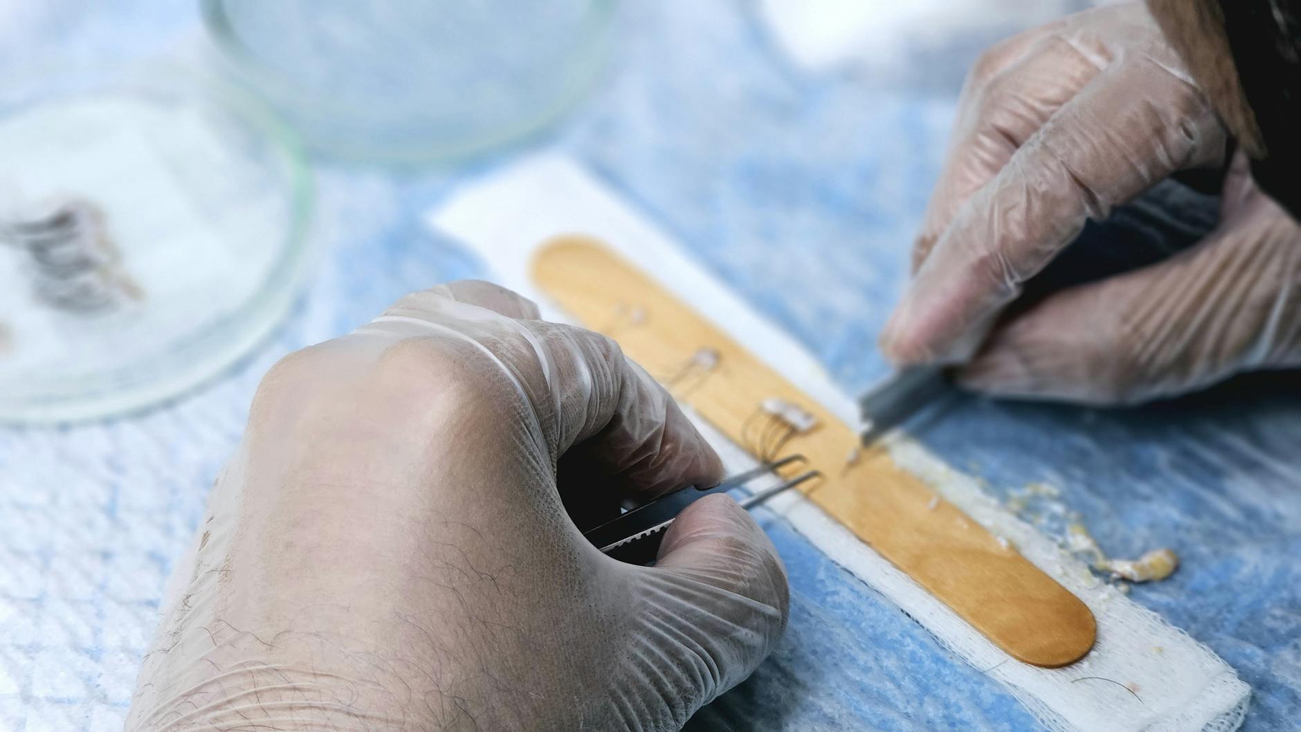 Fecal transplant cuts deadly C. difficile inflammation in hours