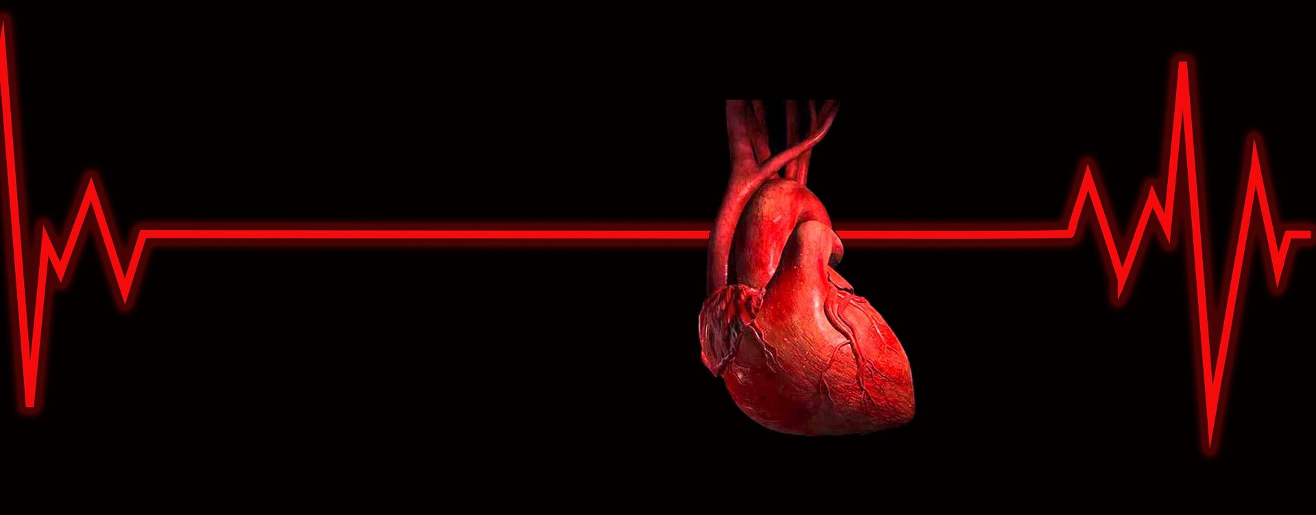 Heart pumps fail to cut damage in high-risk attacks—trial