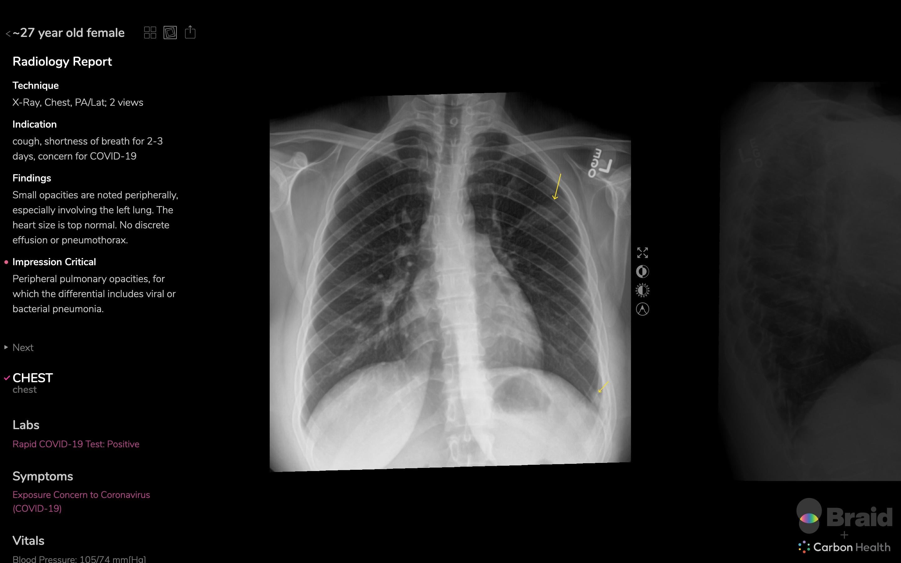 Demo nasuprot deploymenta: tko zapravo može koristiti ovaj pristup