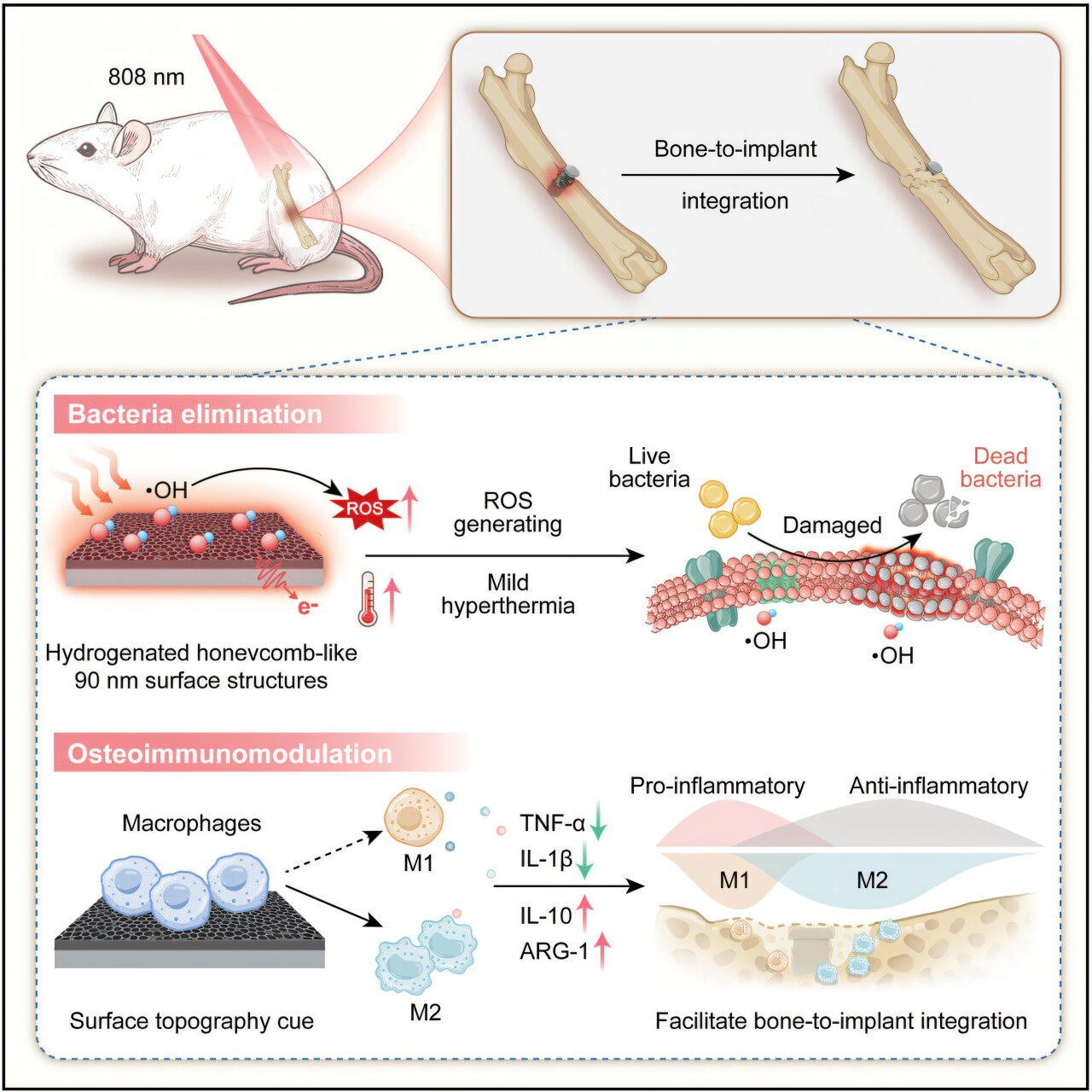 Novo rješenje za infekcije povezanih s implantima — ali još uvijek u istraživačkom stadiju